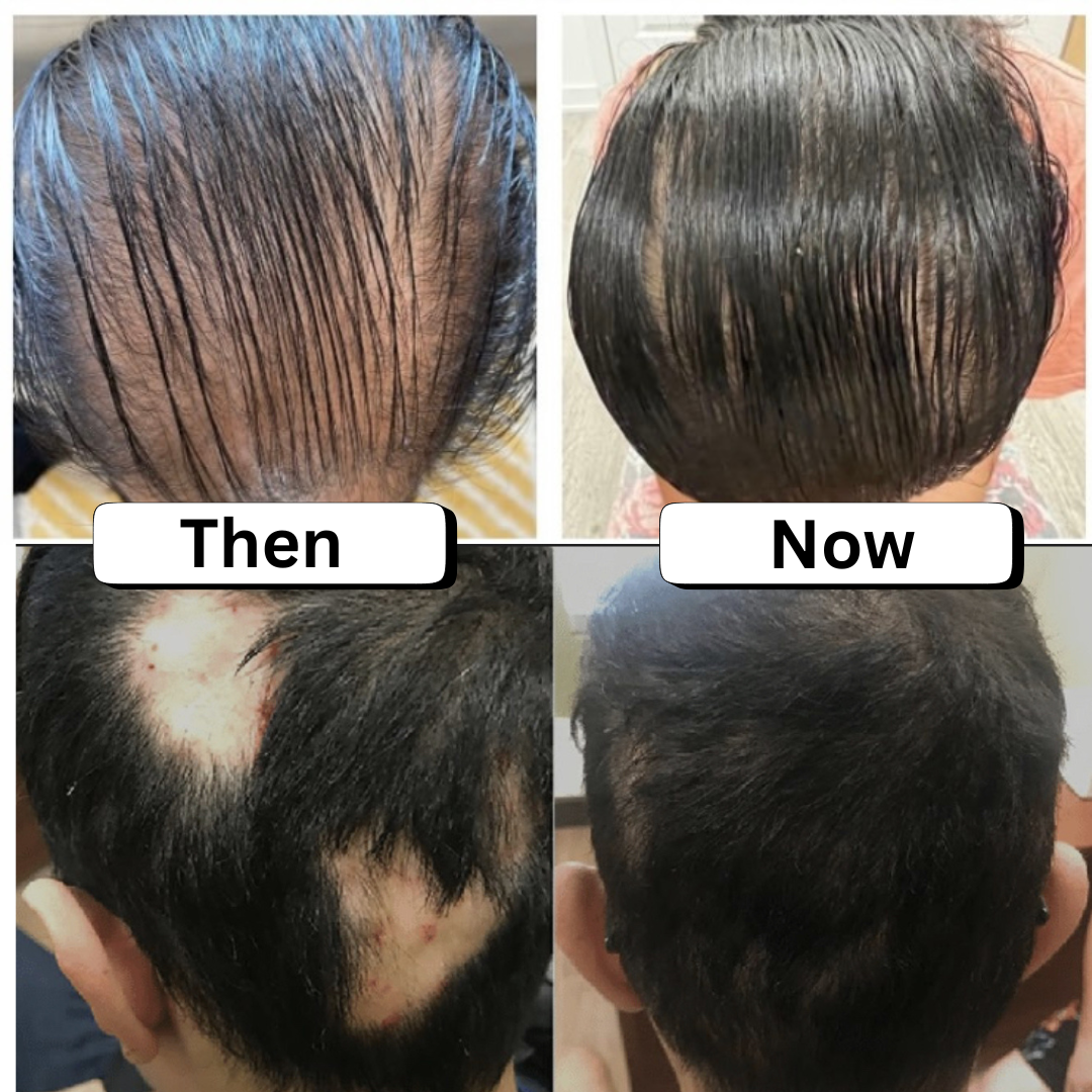 Dr Sebi’s Scalp Stimulator Hair Oil Nourishes Scalp Healthier Hair Growth