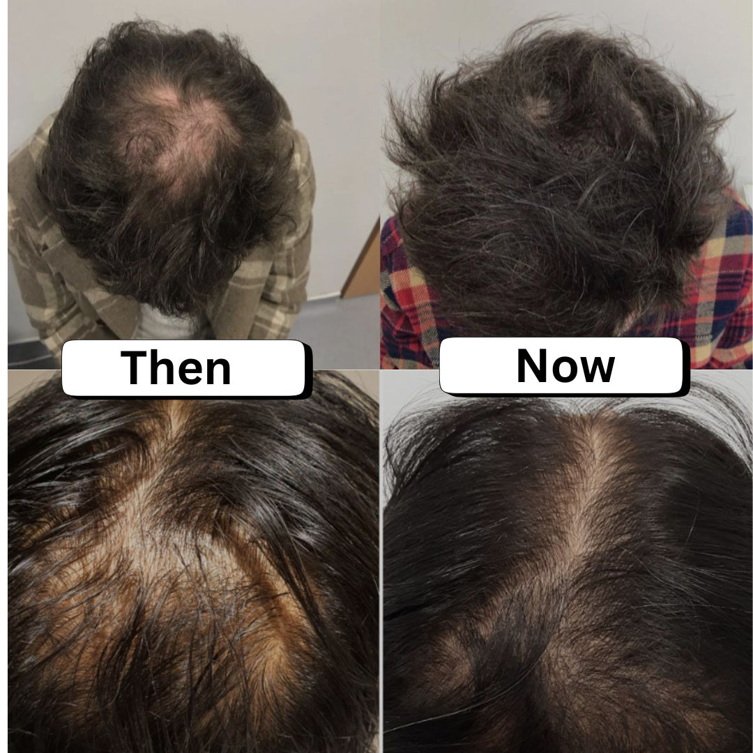 Dr Sebi’s Scalp Stimulator Hair Oil Nourishes Scalp Healthier Hair Growth