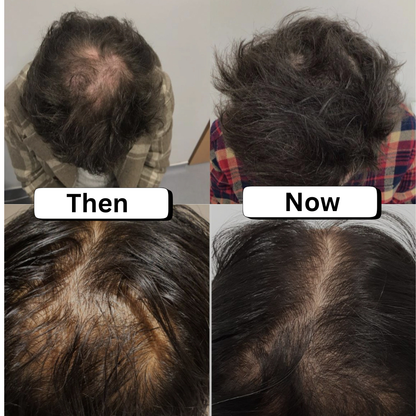 Dr Sebi’s Scalp Stimulator Hair Oil Nourishes Scalp Healthier Hair Growth